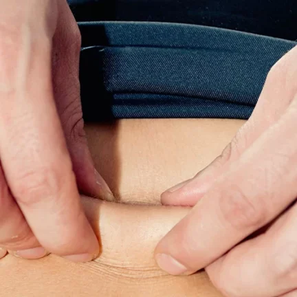 Μυοπεριτονιακή απελευθέρωση